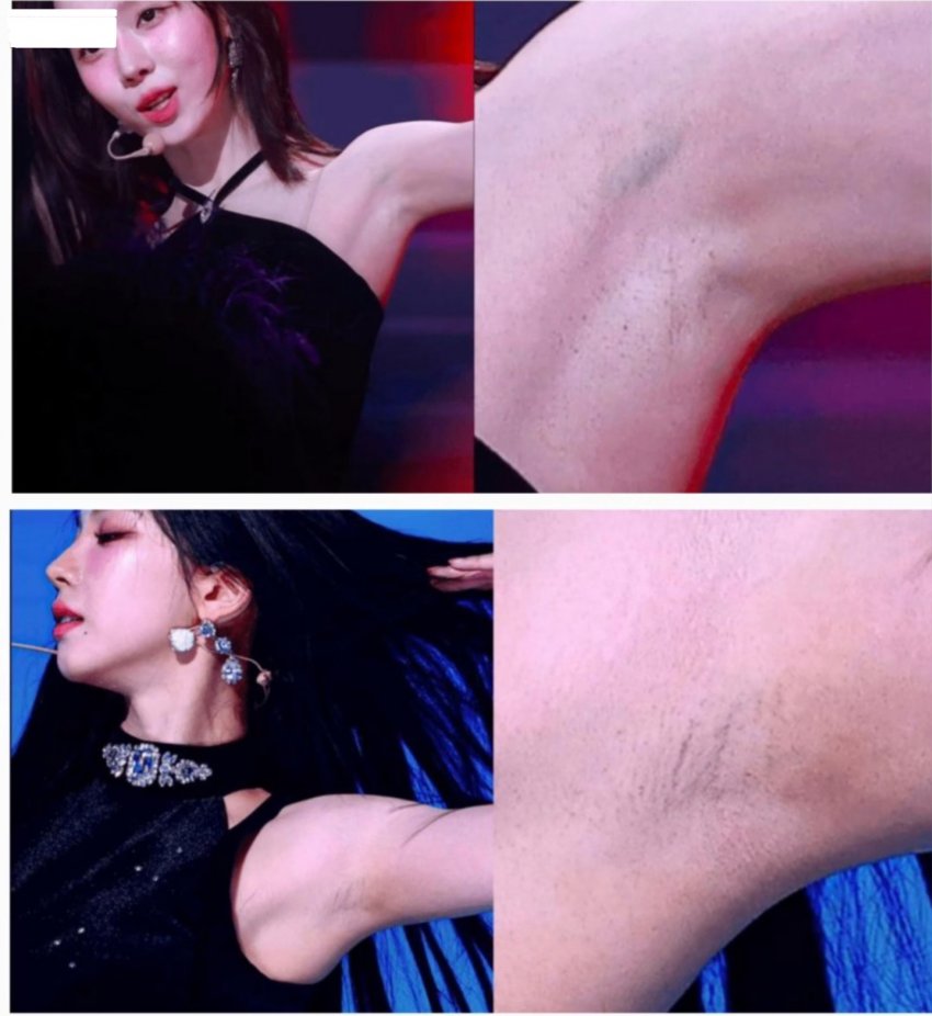 윈터 카리나 겨드랑이 비교_115666_1.jpeg