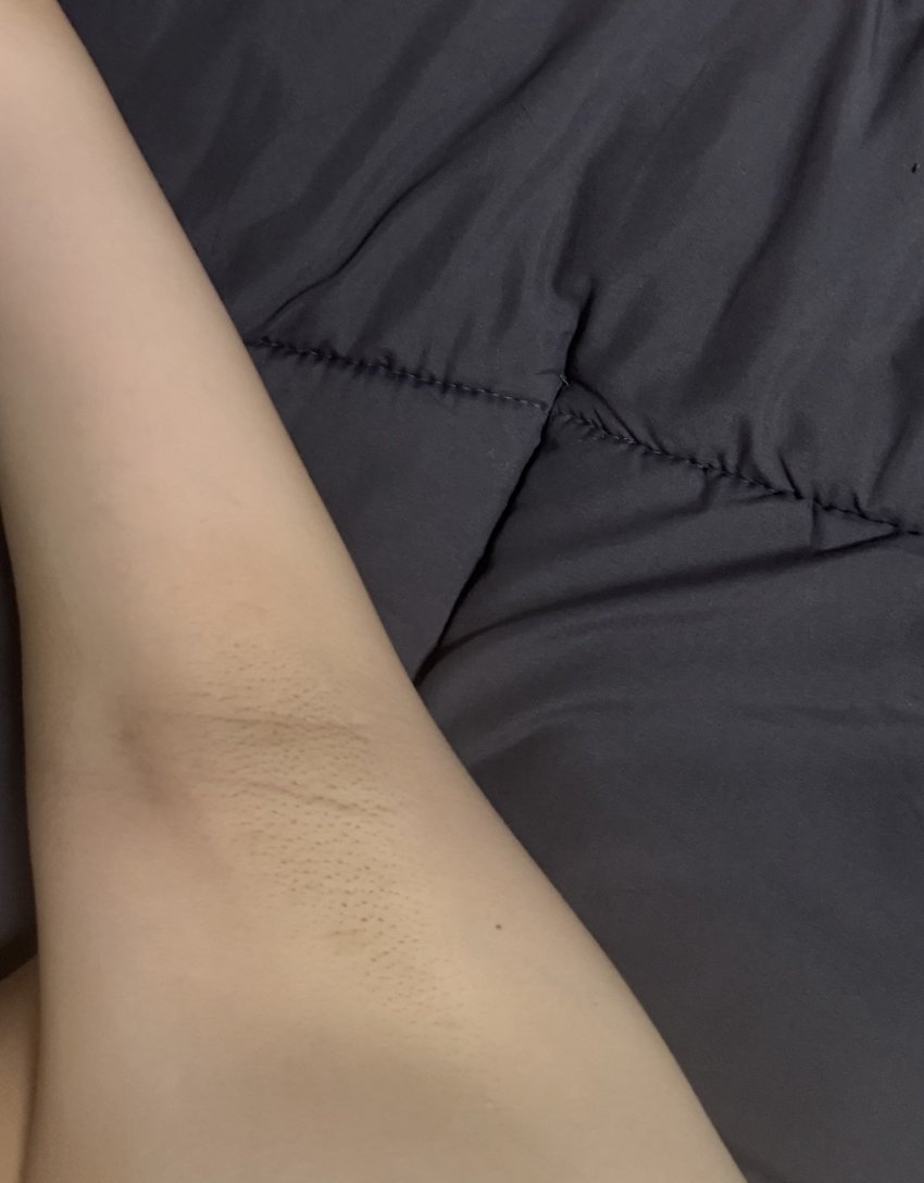 혐주의)여자 겨드랑이좀 봐주세요 어떤편인지_119404_2.jpeg