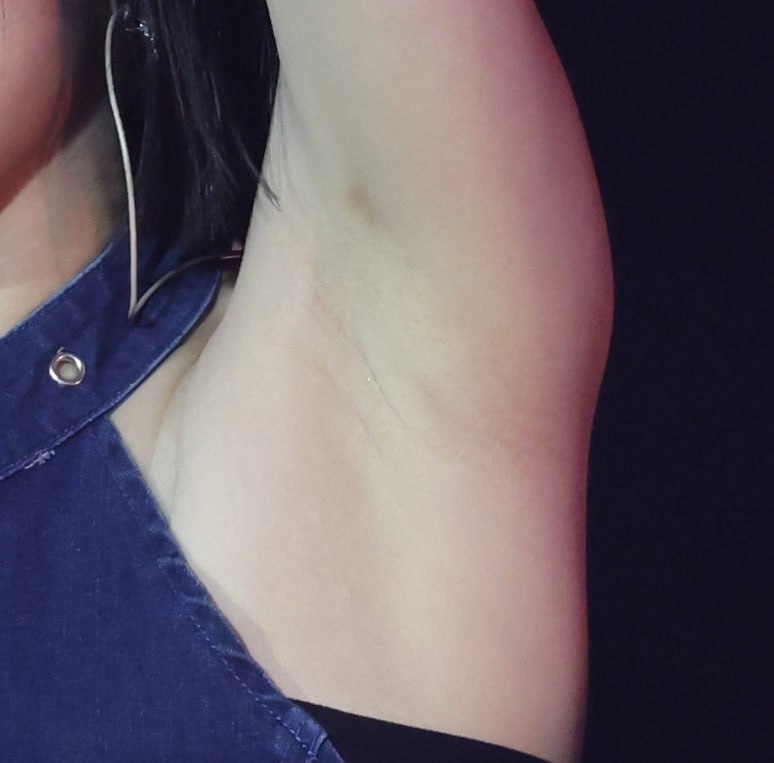 예지 주름_117995_2.jpg