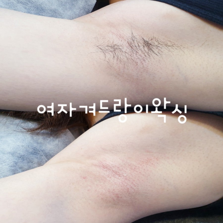 왁싱겨 모음_117190_1.jpg