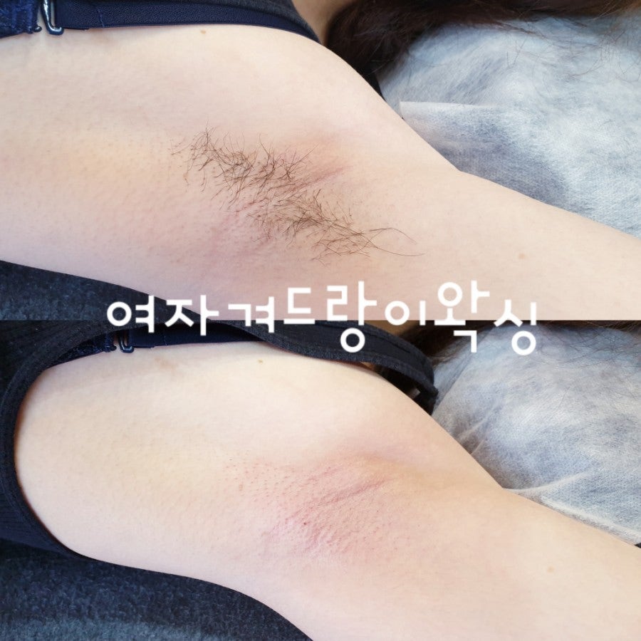 왁싱겨 모음_117190_2.jpg