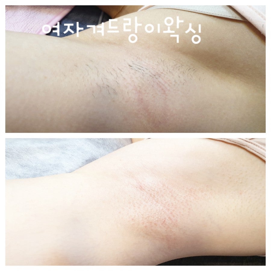 왁싱겨 모음_117190_3.jpg