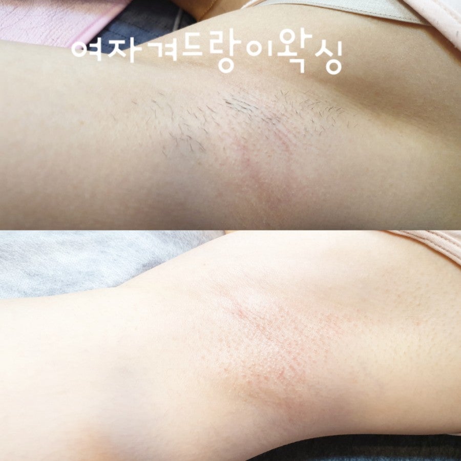 왁싱겨 모음_117190_4.jpg