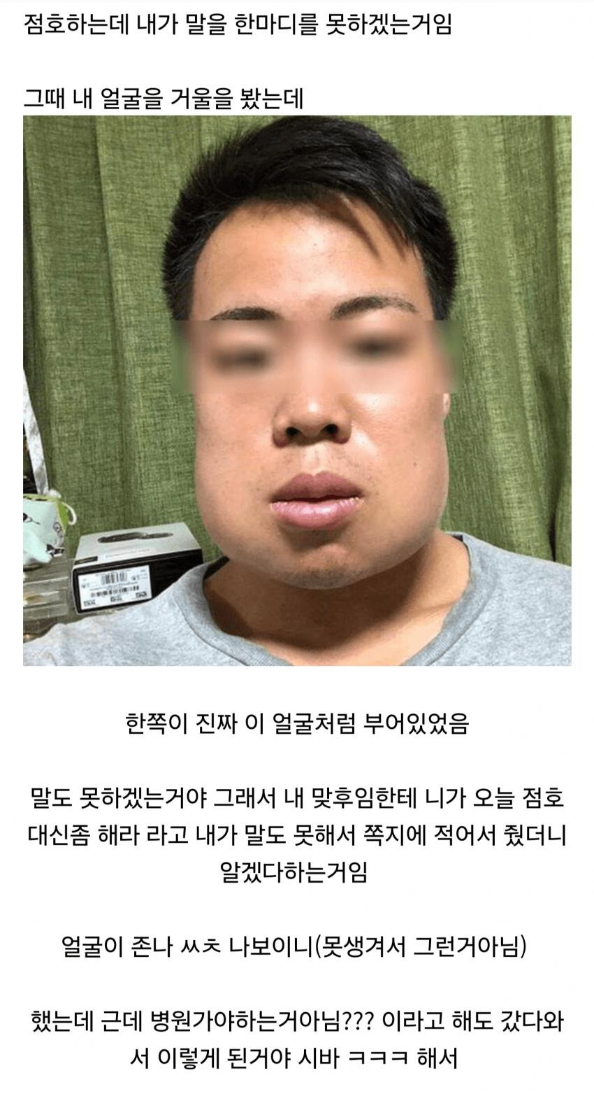 군대에서 마취없이 사랑니 뽑은 썰3.jpg