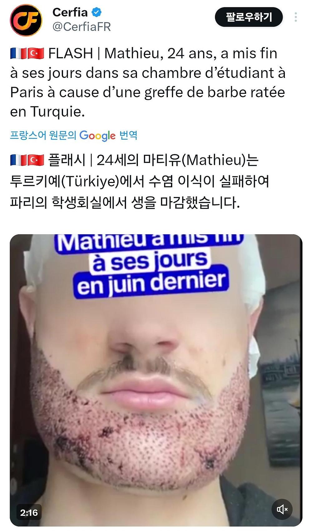 혐) 어느 프랑스 20대 남성 자살 이유1.jpg