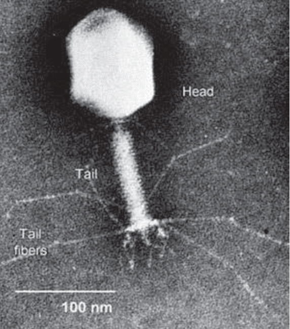 Electron-micrograph-of-a-bacteriophage.png