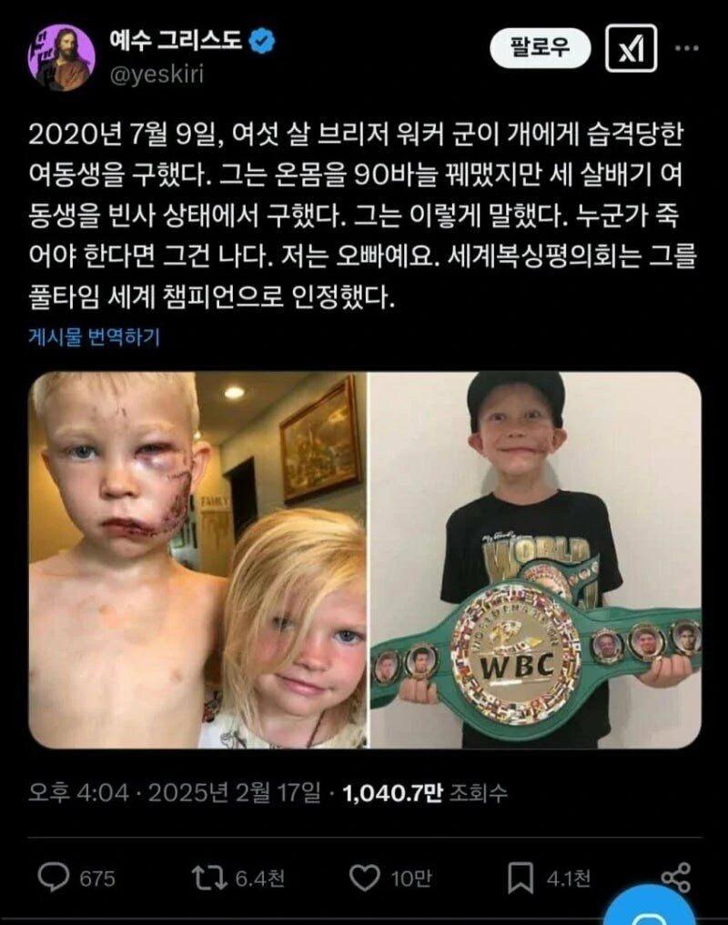 여동생을 개로부터 구한 오빠 근황1.webp.jpg