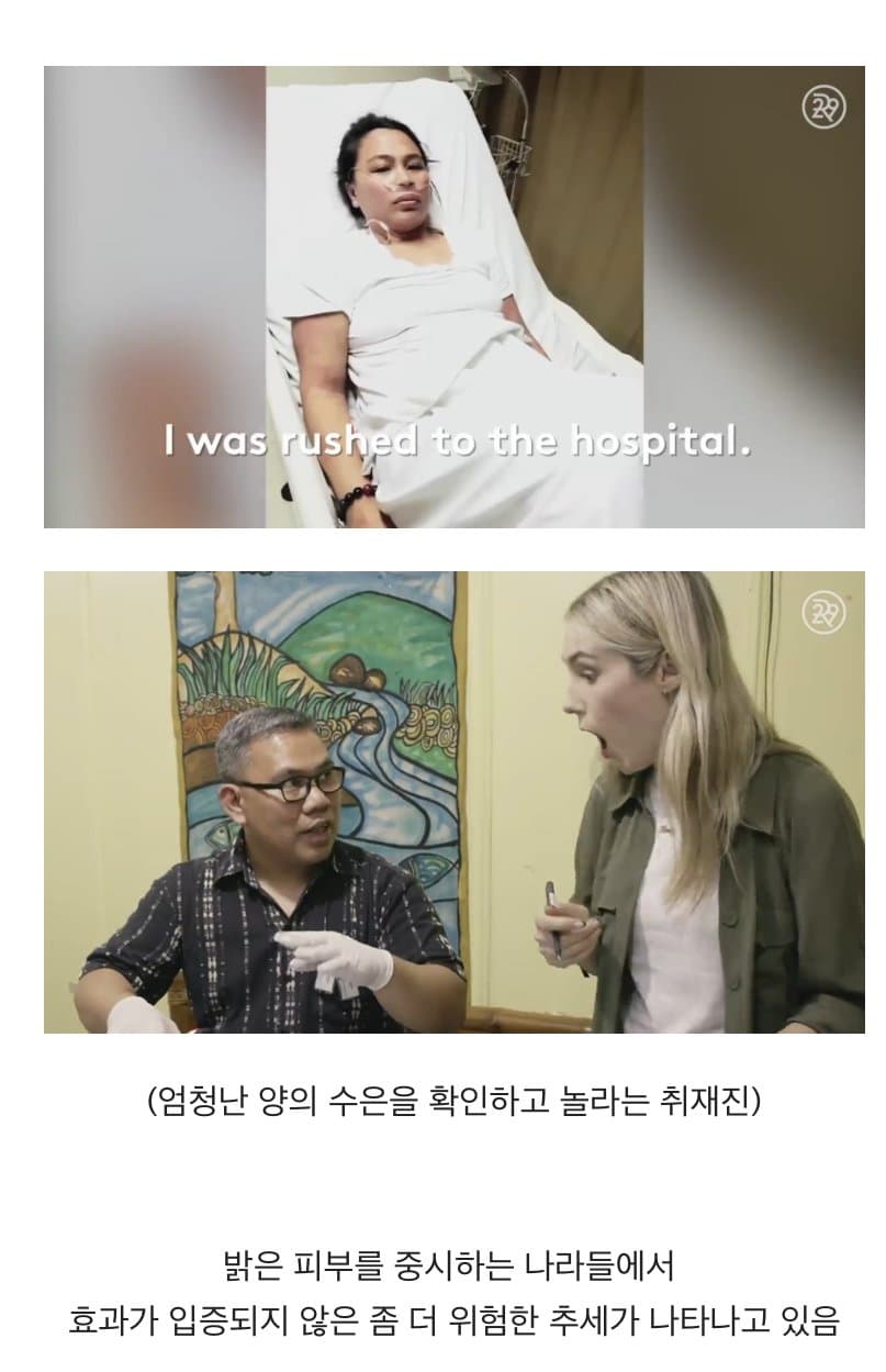 BBC 하얀피부 집착_6.jpg