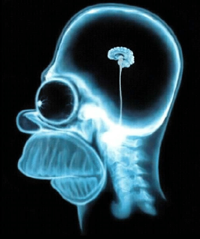 Homer-Simpsons-brain-seen-with-MRI-X-ray-Image-reproduced-on-many-Internet-sites.ppm.png
