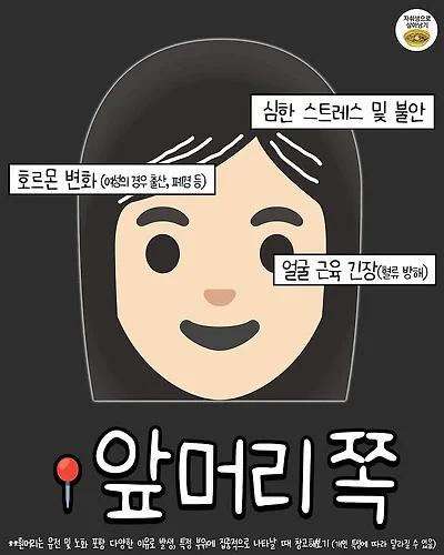 흰머리 나는 부위별 원인 2.webp.jpg